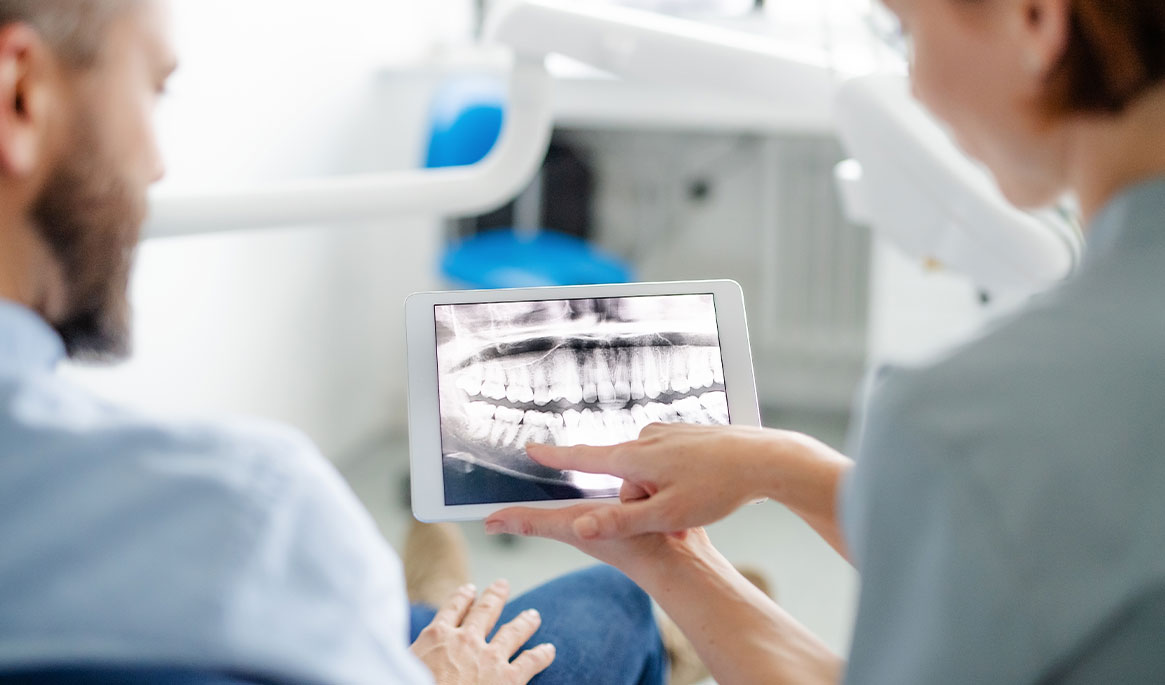 All On 4 Dental Implant Benefits And Costs Guide